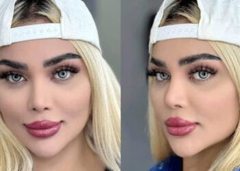 لنز یخی | نگاهی سرد اما خیره کننده